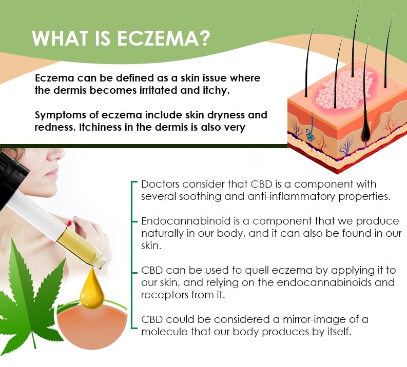 Eczema, How Eczema Can Be Treated with Cannabis